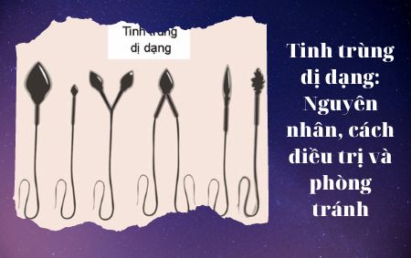 Tinh trùng dị dạng