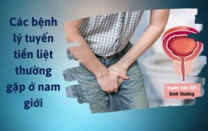 Bệnh lý tuyến tiền liệt