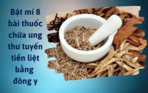 Chữa ung thư tuyến tiền liệt bằng đông y