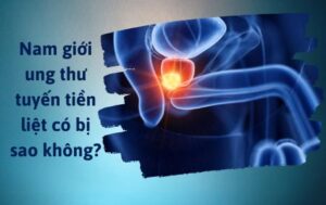 Ung thư tuyến tiền liệt có bị sao không