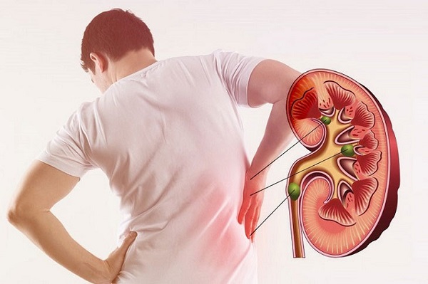 Biến chứng nguy hiểm của viêm tuyến tiền liệt