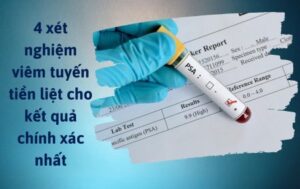 Xét nghiệm viêm tuyến tiền liệt